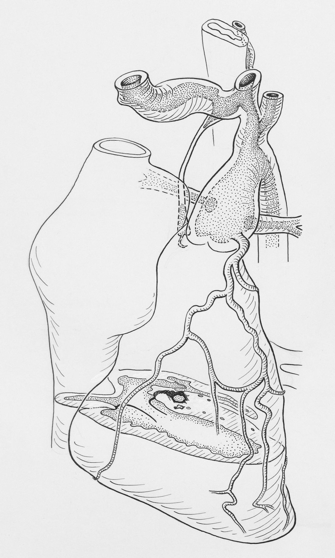 The heart and major arteries